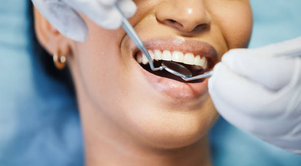 Best Knocked-Out Tooth Emergency  in Port Salerno, FL